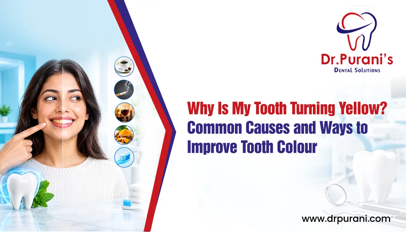 Why Is My Tooth Turning Yellow? Common Causes and Ways to Improve Tooth Colour