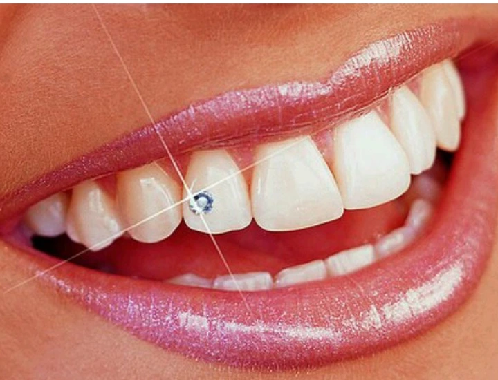 Dental Jewellery